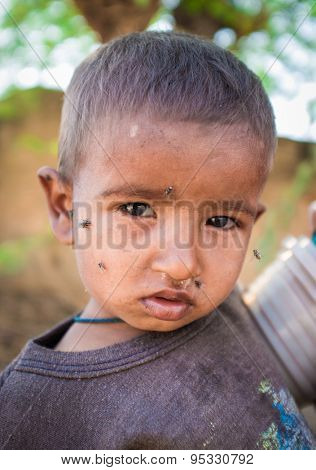 GODWAR REGION, INDIA - 15 FEBRUARY 2015: Young Indian child with flies around face.