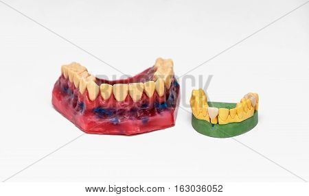 Technical shots of models on a dental prothetic laboratory