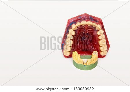 Technical shots of models on a dental prothetic laboratory