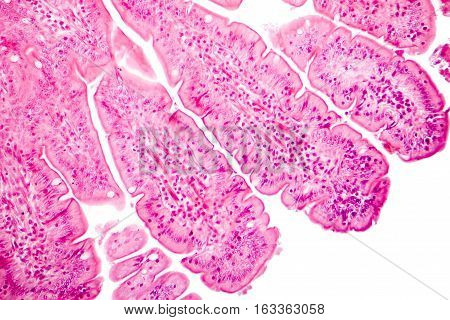 Villi of small intestine, light micrograph, magnification 100x