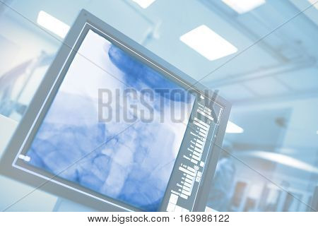 Computer monitoring in hospital cathlab. Modern equipment