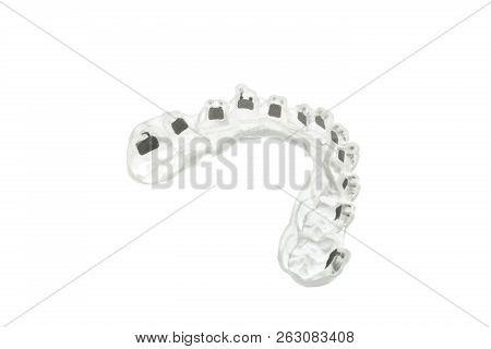 System Of Braces For Teeth On White Isolated