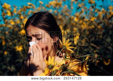 Young Girl Sneezing And Holding Paper Tissue In One Hand And Flower Bouquet In Other. Sneezing Young
