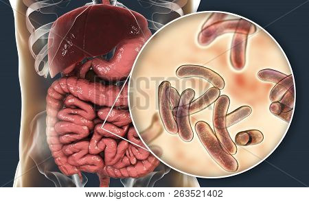 Vibrio Cholerae Bacteria In Small Intestine, 3d Illustration. Bacterium Which Causes Cholera Disease