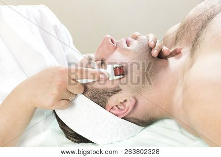 The Man Undergoes The Procedure Of Medical Micro Needle Therapy With A Modern Medical Instrument Der