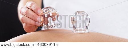 Cupping Therapy Using Vacuum Chinese Glass. Cup Massage