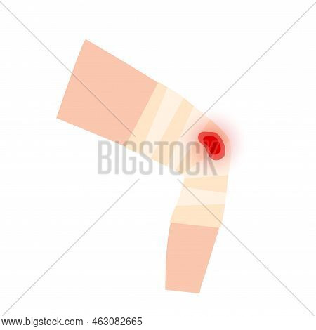 Sore, Cut Or Ulcer On Human Leg. Elastic Bandage, Wrap Medical Gauze Over Knee. Healthcare Concept. 