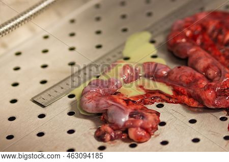 Pyometra - Uterus Inflammation After Surgical Operation To Remove Uterus From A Dog At The Veterinar
