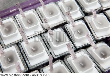 Embedded Tissues In Paraffin Blocks For Sectioning. Pathology Laboratory. Cancer Diagnosis.