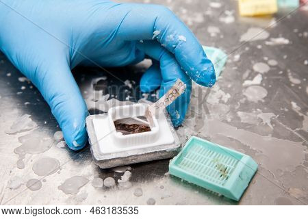 Scientist Embedding Tissues In Paraffin Blocks For Sectioning. Pathology Laboratory. Cancer Diagnosi