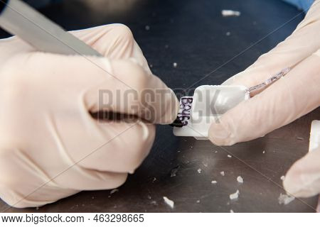 Scientist Preparing Paraffin Blocks Containing Biopsy Tissue For Sectioning. Pathology Laboratory. C