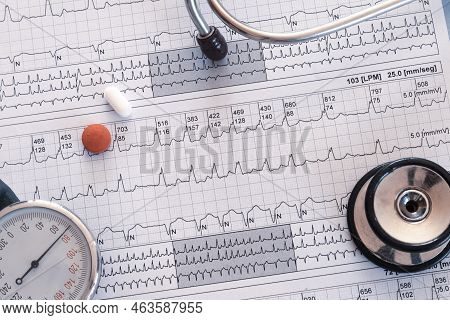 Electrocardiogram Showing A Supraventricular Tachycardia And Colored Pills. Medical Desk Concept Or 