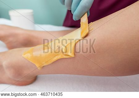 Leg Sugaring. A Beautician Makes A Sugar Paste Depilation Of A Woman's Legs In A Beauty Salon. Femal