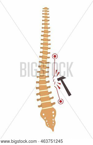 Spinal Deformity. Symbol Of Spine Curvatures Or Unhealthy Backbones. Human Spine Anatomy, Curved Spi