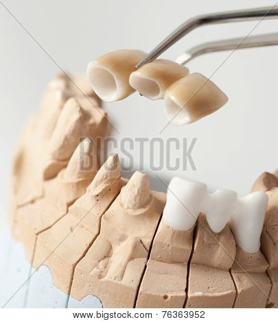 Technical shots on a dental prothetic laboratory