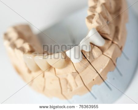 Technical shots on a dental prothetic laboratory