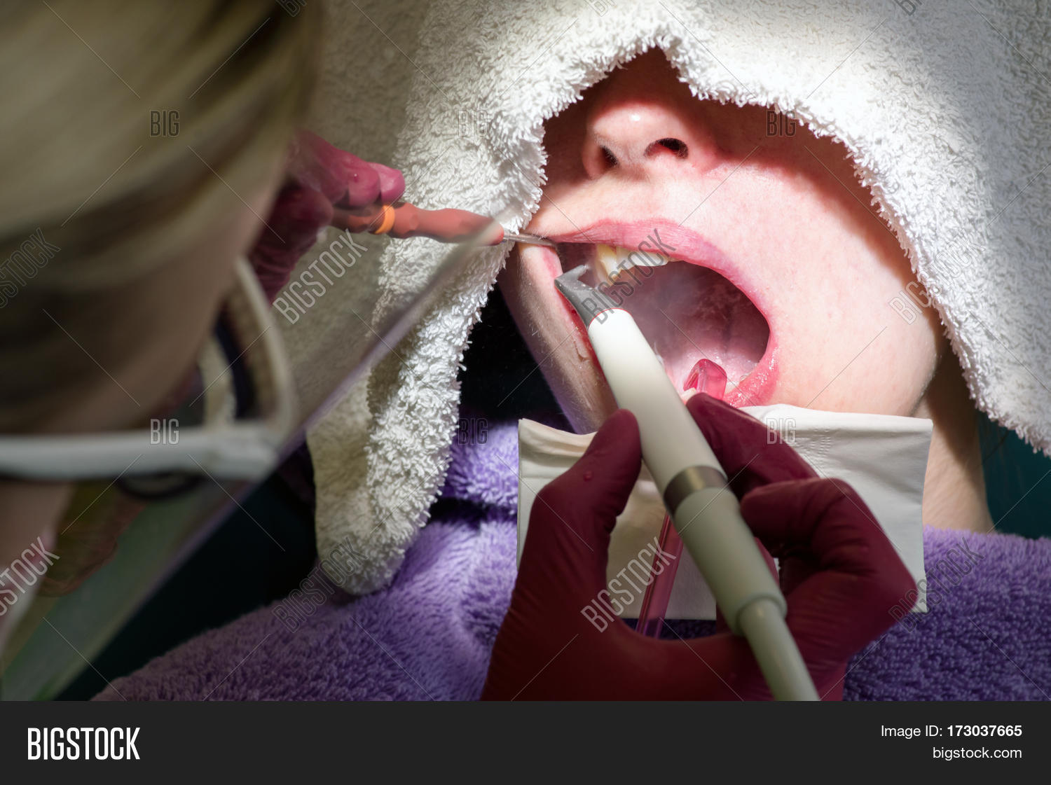 Sandblasting Machine Image & Photo (Free Trial) Bigstock