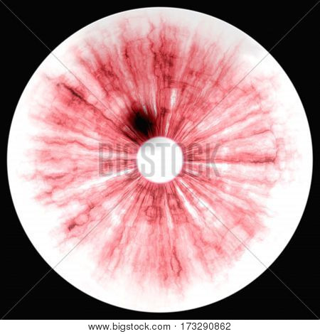 Eye Rtg. Illustration Of Human Eye In Rentgen Photo