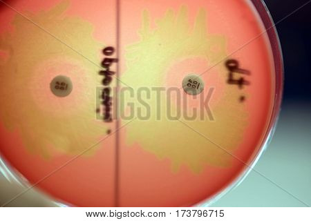 Optochin Subsensitivity Test On Blood Agar Plate Contains Small Light Grains For Streptococcus Pneum