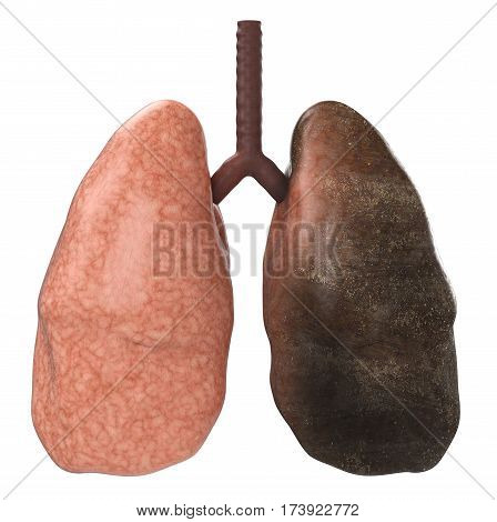 Good And Bad Lungs