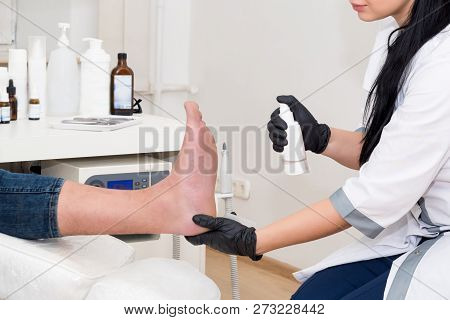 Podology Treatment. Podiatrist Treats Foot. Podiatry Doctor Or Dermatologist Treats The Patient In M