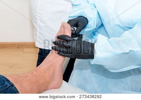 Podology Treatment. Podiatrist Treats Foot. Podiatry Doctor Or Dermatologist Treats The Patient In M