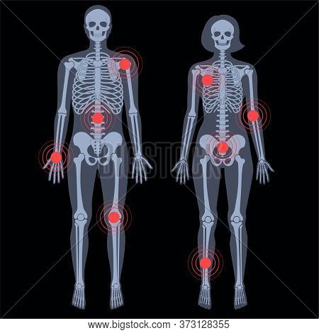 pic Anatomy Male Vs Female Skeleton human woman man vector photo free