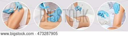 Cosmetologist Makes Lipolytic Injections To Burn Fat On The Thighs, Hips And Body Of A Woman. Female