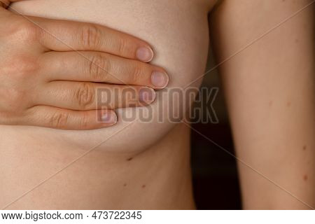 Unrecognizable Women Topless Doing Self-checks For Breast Cancer. Bse Checking Up Breast Changes, Po