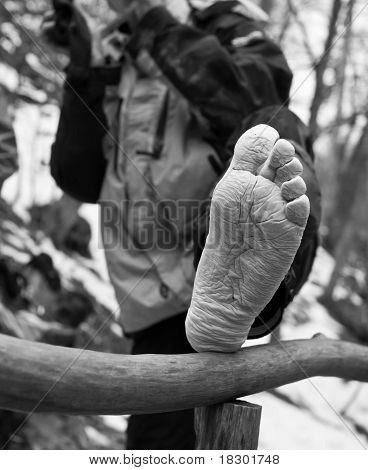 ขาของนักท่องเที่ยวหลังจากเดินยืดเยื้อ