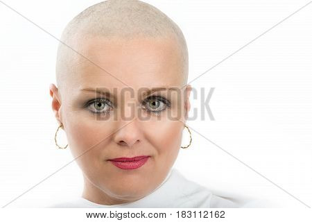Beautiful Middle Age Woman Cancer Patient Without Hair