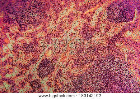 Lymph Node Dog