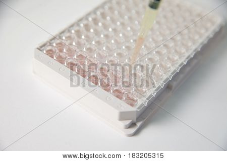 Conducting laboratory medical tests and tests the ELISA method