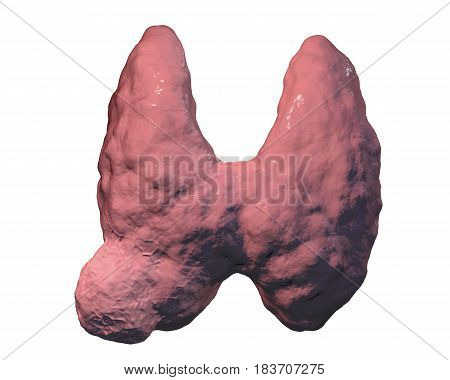 Thyroid cancer. 3D illustration showing thyroid gland with tumor isolated on white background