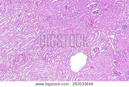 Histology Of Human Tissue, Show Kidney Tissue As Seen Under The Microscope, 10x Zoom