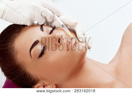 Portrait Of Beautiful Woman Gets Injection  In Her Lips. Closeup Hand In Glove With Syringe Making I
