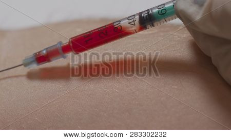 Blood Sampling With Syringe And Needle For Analysis