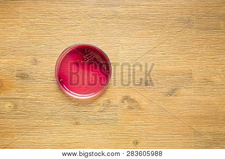 Staphylococcus Aureus Bacteria In Blood Agar Plate. Lab Testing For Infection.bacterial Colony Growt