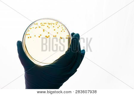 Hand Holds Petri Dish With E.coli Escherichia Bacteria. Lab Testing For Intestinal Infection.bacteri