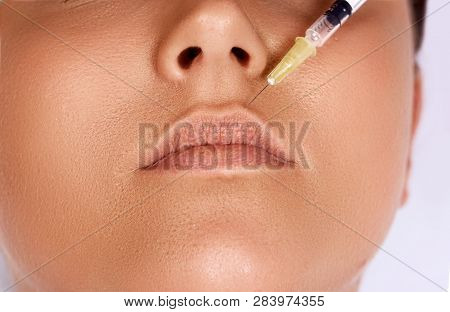 Closeup Of Procedure To Lip Augmentation. Beautiful Young Woman Mouth Receiving Hyaluronic Acid Inje