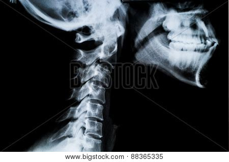 X Ray Neck And Jaw