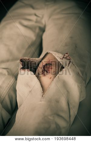 Close Up Of Torn Pants With Large Bleeding Gash