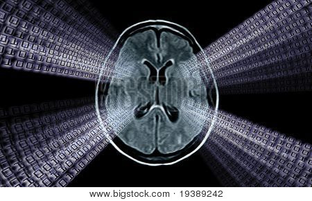 imagen de exploración del cerebro mri para diagnóstico médico