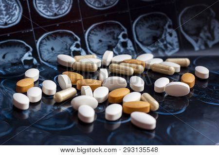 Different Pharmaceutical Medicine Pills On Magnetic Brain Resonance Scan Mri Background. Pharmacy Th