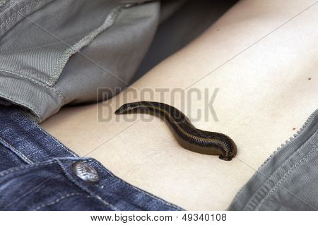 약용 거머리 hirudo medicinalis