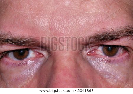  Olhos ligeiramente vermelhos