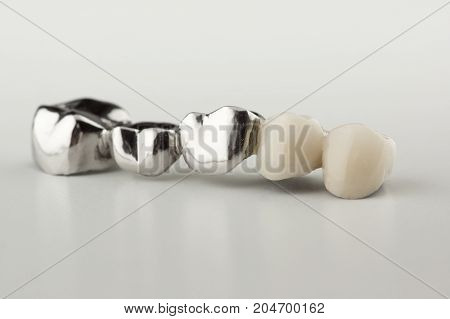 Bridged dental prostheses are made of steel and ceramic paste