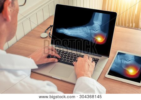 Doctor Watching A Laptop With X-ray Of Pain Relief In The Heel Of A Foot In A Office
