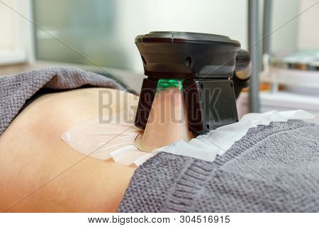 Cryolipolysis Freeze Fat Procedure In Cosmetic Cabinet Or Spa Salon, Belly Close-up