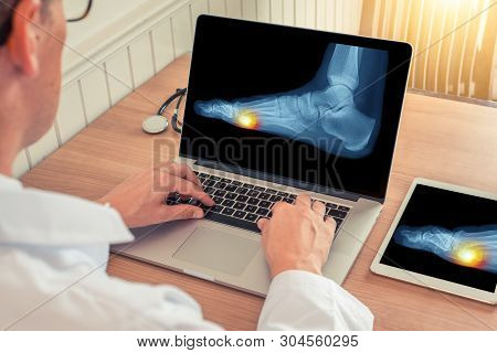 Doctor Watching A Laptop With X-ray Of Pain Relief Under A Foot In A Office